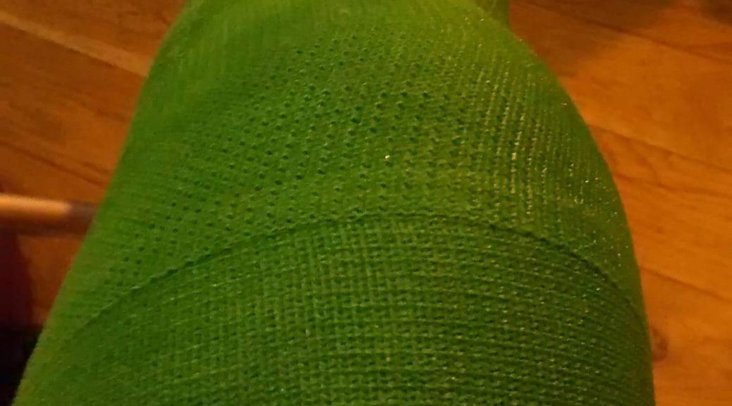 Green Cast